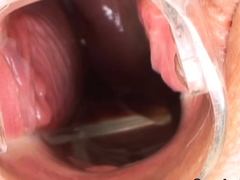 Deepthroat teen gapes hole with speculum